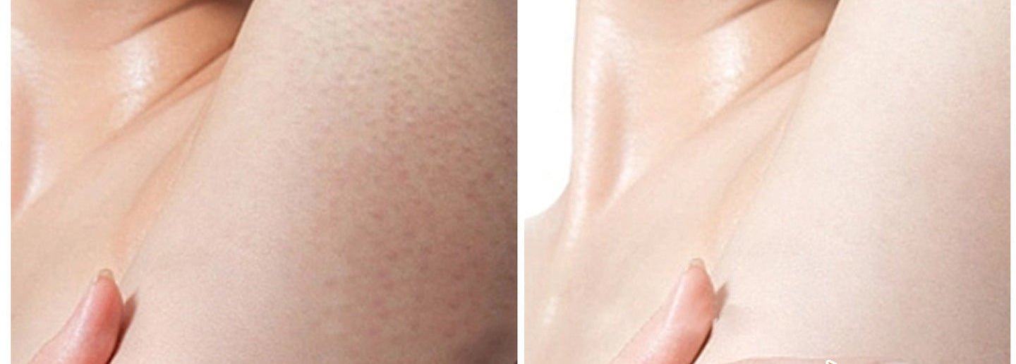 Turmeric Oil 30ml - For The Face Turmeric Serum For Dark Spots Corrector Serum For Face & Body, Anti Aging Facial Serum For Women Men, Reduces Hyperpigmentat - VibraStore